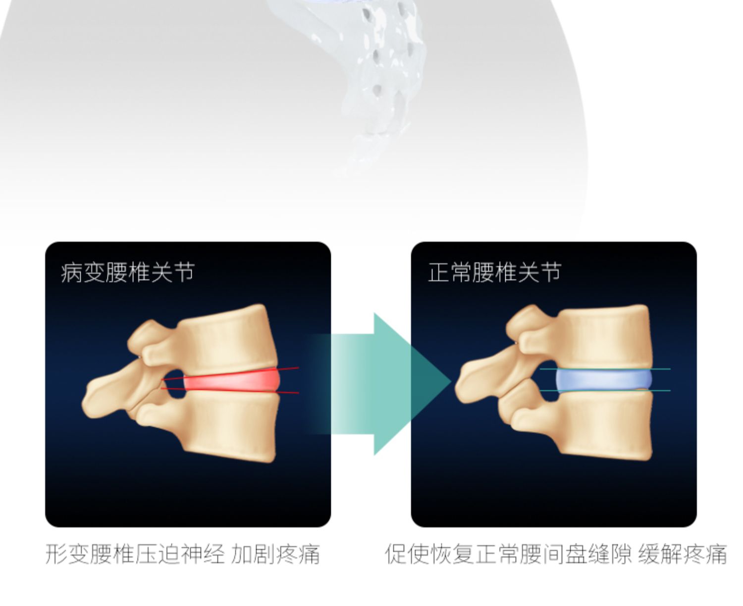 康舒护腰带腰间盘突出腰肌劳损治疗