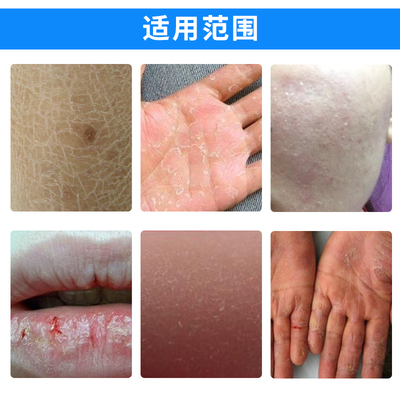 正品奇力康护手防裂保湿滋润甘油 商品反馈