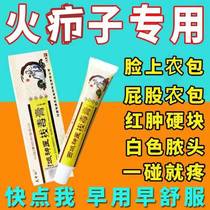 Fire boils pull out poison pull out pus red swelling pull out poison pimples pimples sit pull sores buttocks boils