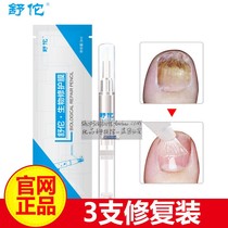 Biofilm black technology Shu Tuo Yibi bright care liquid special liquid Gray nail biological repair film Gray tea nourishes nail root