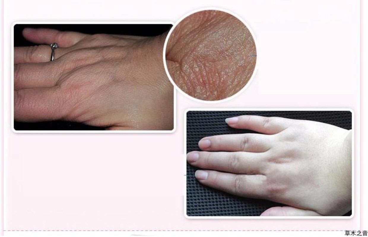 悠采蜗牛手膜嫩白保湿补水去死皮淡化细纹手部护理手套保养套装