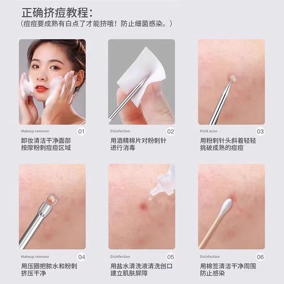 블랙 헤드와 여드름 클립을 제거하는 핀셋 스크랩 닫힌 입 여드름 바늘 픽 여드름과 짜기 여드 블랙 헤드와 여드름 클립을 제거하는 핀셋 스크랩 닫힌 입 여드름 바늘 픽 여드름과 짜기 여드