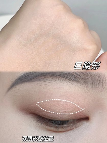 레이스 보이지 않는 이중 눈꺼풀 패치, 자연스럽고, 표시되지 않은, 부은 및 눈 안에는 이중 특정 눈 패치, 비 반사 올리브 모양을위한 인공물 레이스 보이지 않는 이중 눈꺼풀 패치, 자연스럽고, 표시되지 않은, 부은 및 눈 안에는 이중 특정 눈 패치, 비 반사 올리브 모양을위한 인공물