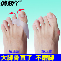 Thumb Valgus toenails daily can wear shoes female large footed bone overlapping cisner male toe m outer counter-toe cushion