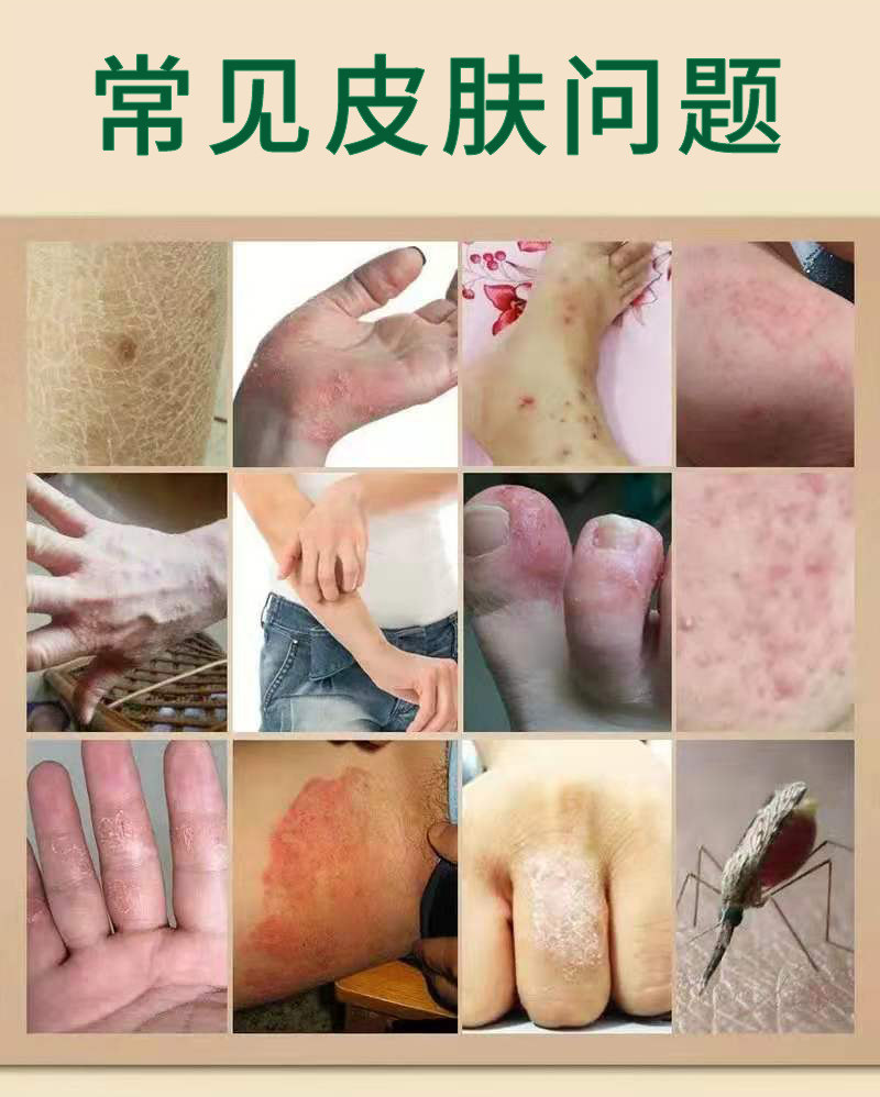 御肤王苗家无敌膏【详细介绍】真假 (报价格)多少钱