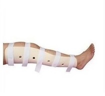 Ankle Osteoarticular Fixation High Molecular Ankle Fracture Lower Limb Detachment Ankle Metatarsal Shin Fibula Hyperankle