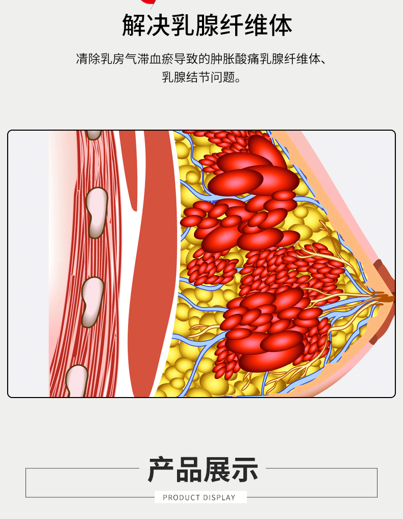 乳腺增生贴小叶结节疏通副乳消奶结肿块疼痛硬块囊肿散