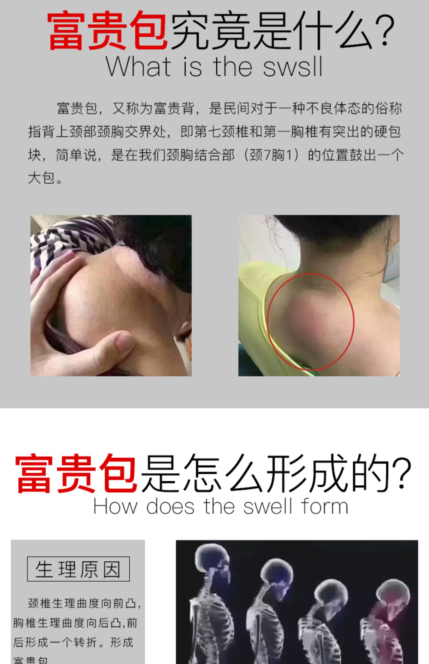 富贵包消除贴颈椎贴一盒5贴96元- 800折扣网