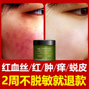 去红血丝面霜激素脸部抗过敏皮肤晒后修复舒缓