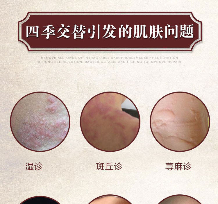 百草湿毒止痒膏荨麻风团诊过敏药皮肤瘙痒外用药阴囊草本抑菌乳膏_淘