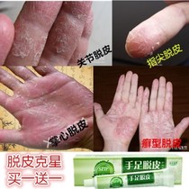 Seasonal Hand Peeling Repair Cream Hand Burst Leather Finger Barbs Cracking Palm Hand Metaskin Medicine Dry Crack Hands Up
