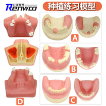 Maxillary sinus lifting drill model dental implant practice model oral implant soft gingival dental materials