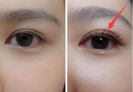 睫毛短稀少不好看?教你几个小妙招!