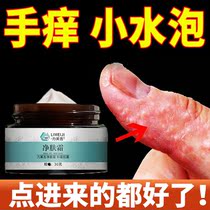 Itchy hands small blisters on the hands peeling hands chapped hands wet poison sweat spore rash goose palm wind non-itching non-ointment