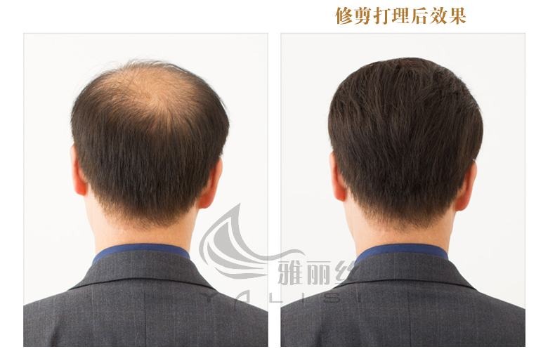 男士头顶隐形补发真发补发块全手织无痕真发补发片增发量遮盖白发