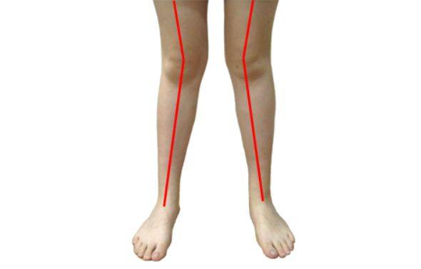 外八的腿型也是同理,选择长裙比较适合.