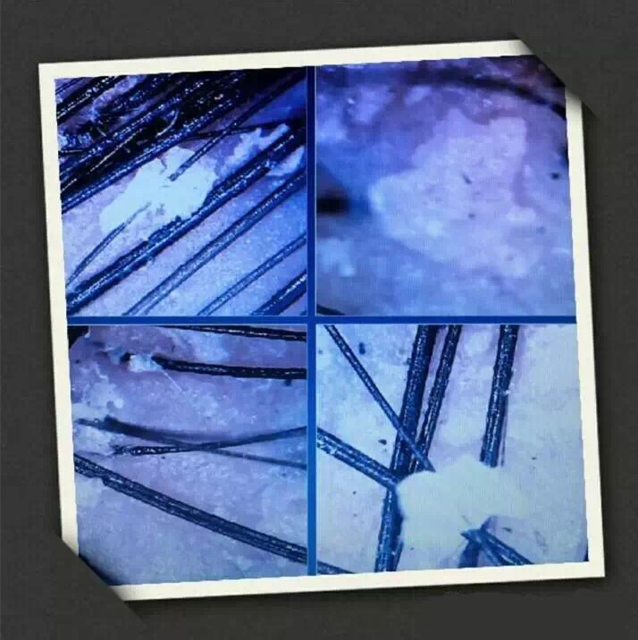 (显微镜下一般人的头皮)