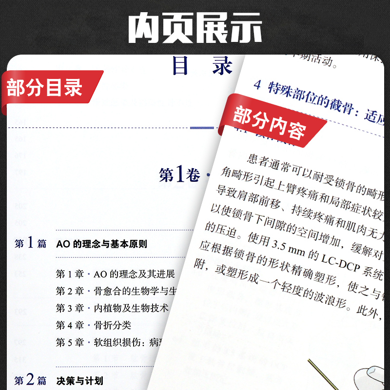 new edition of ao principles for spot fracture treatment third edition third edition wang manyi orthopedics orthopedics doctor reference surgical atlas internal fixation anatomy osteosynthesis technical reference  a0 shanghai science and technology press