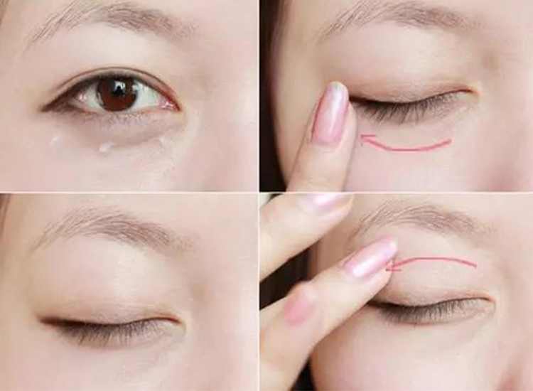 step 2:提拉眼角.中指和无名指并拢,交替提拉眼角至太阳穴,重复20次.