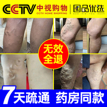 Ouquan Lin varicose vein cold compress gel earthworm legs special cream for the treatment of external use of cord legs authentic medical use