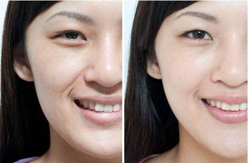 肌肤补水前后的对比,年轻了不止20岁啊