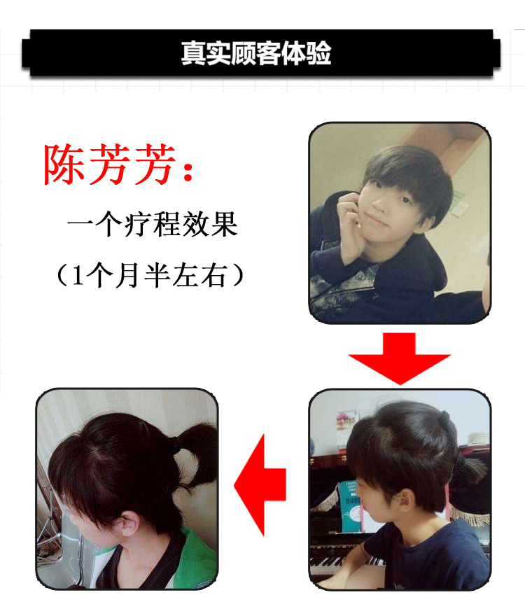 【无效我吃掉】 头发3-5倍自然生长速度