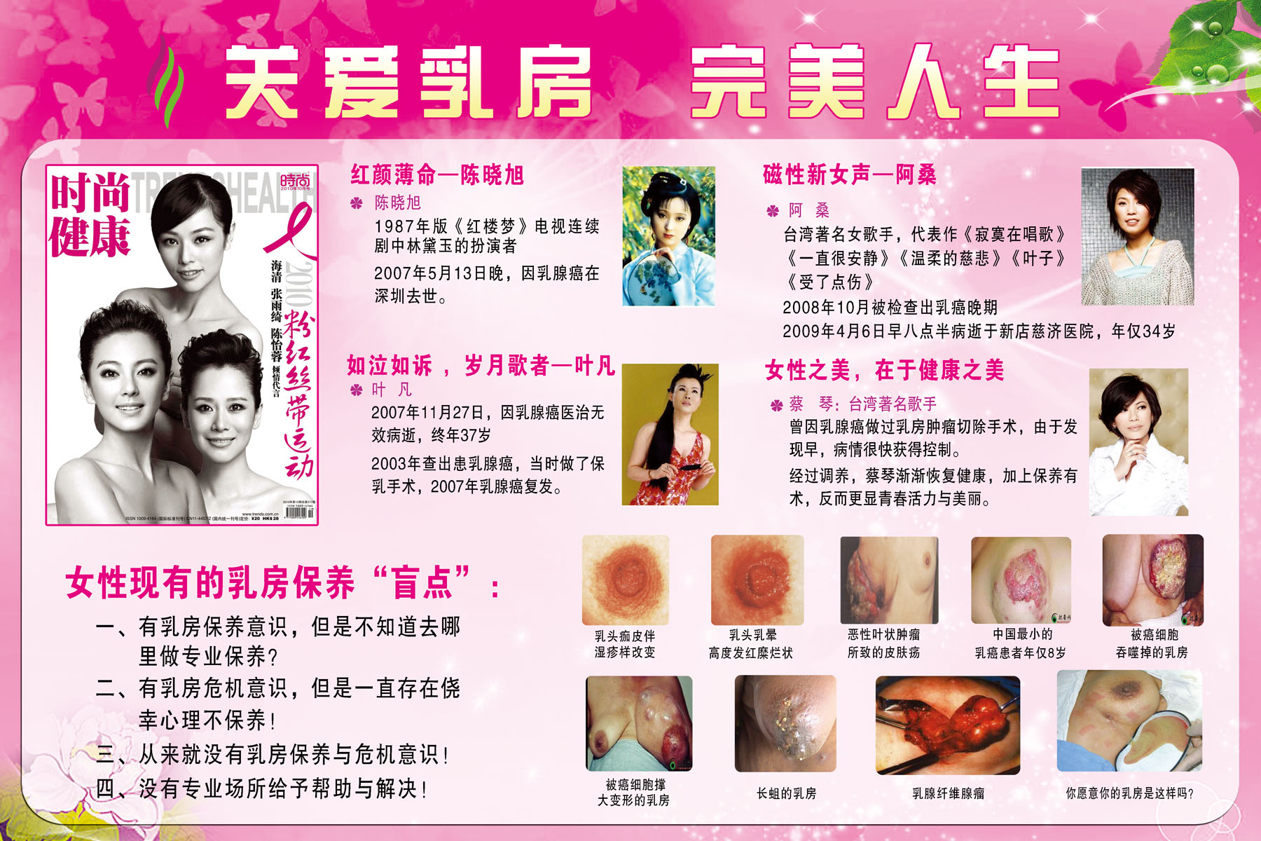 如何预防乳腺癌 预防乳腺癌的食物和方法