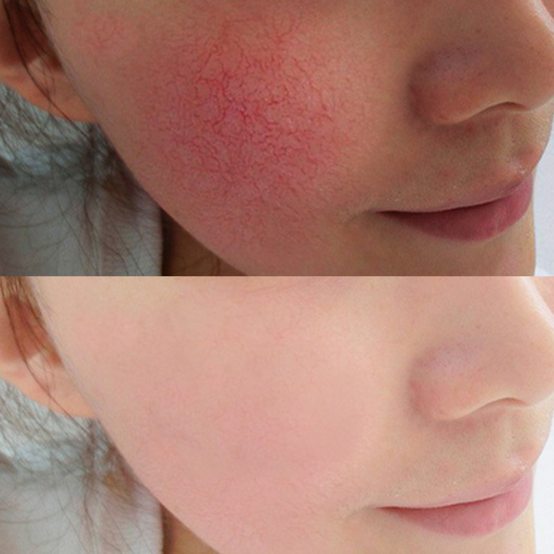 玛雅帕帕拉蚕丝面膜贴改善红血丝修复面膜紧致舒缓滋润肌肤10片装