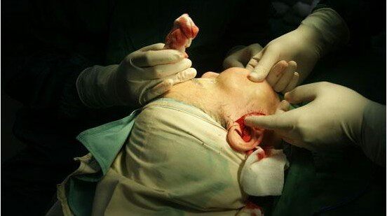 围观~血腥和恐怖的整容全程现场直播!