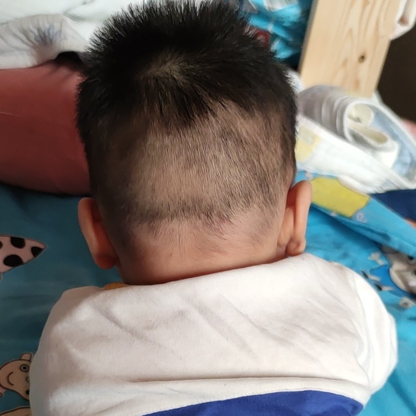 桉树VS树袋熊的爱情