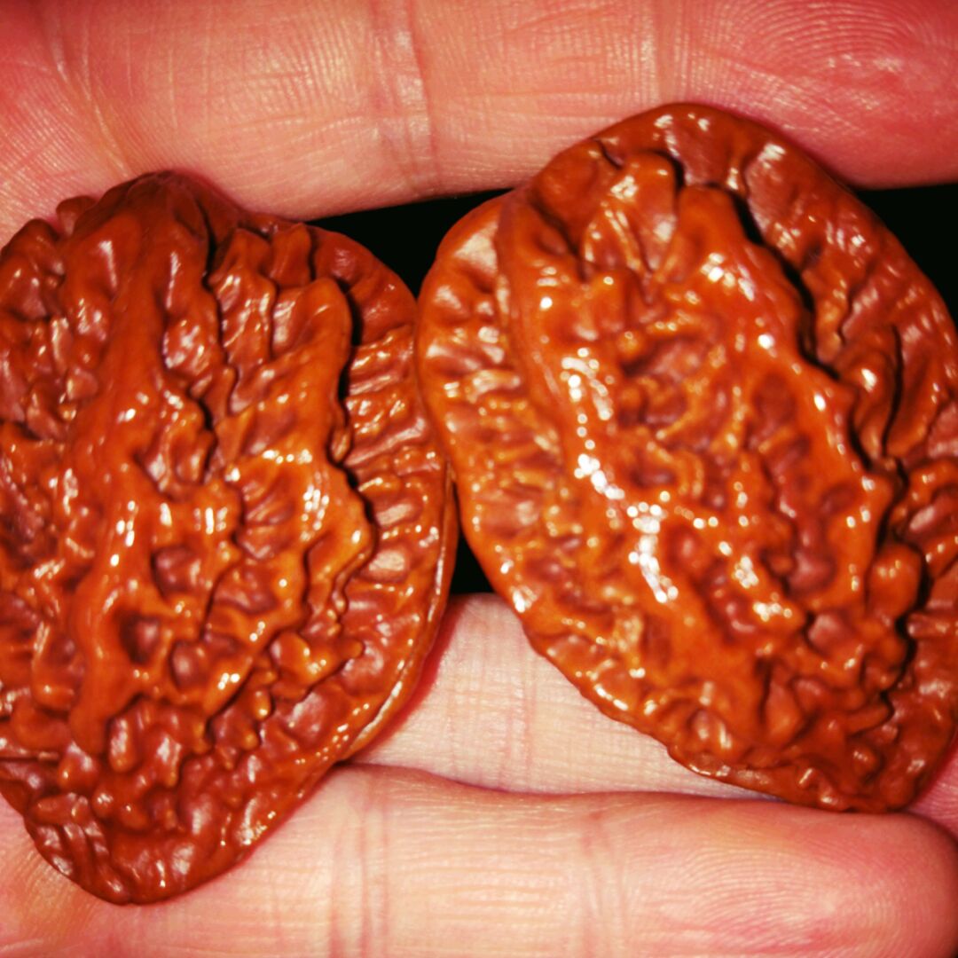 爱吃金沙牛肉的芬达