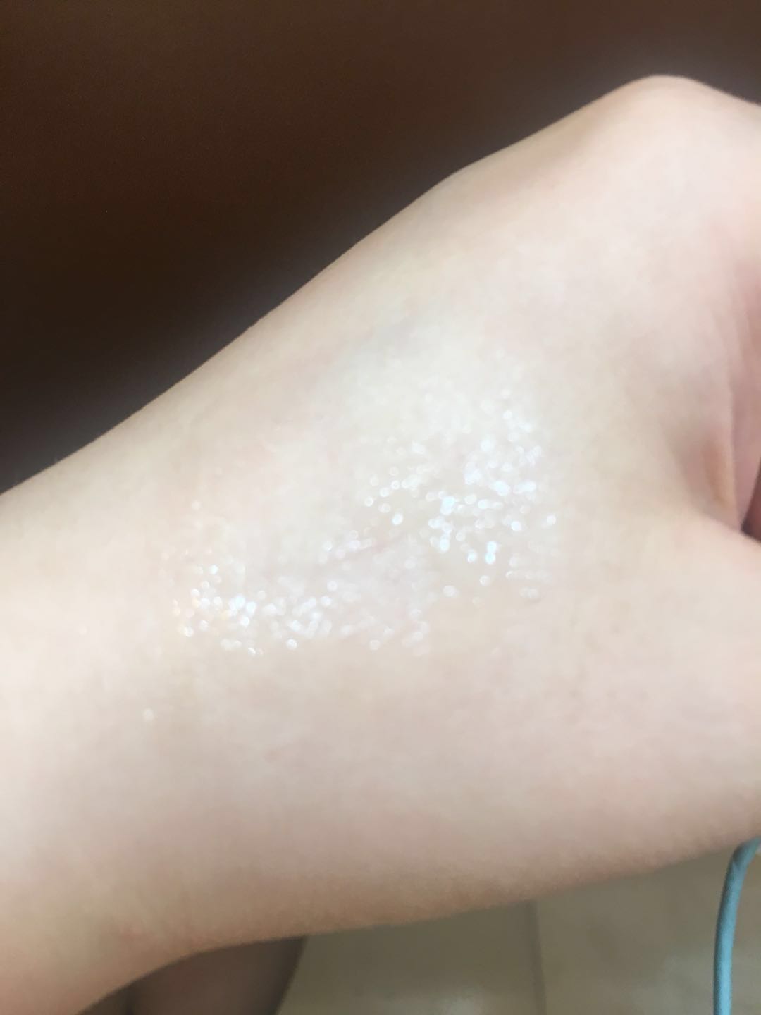 雄鹿壳聚糖护创凝胶 去疤痕 效果怎么样,真的好用吗?使用两周真实效果,第10张 雄鹿壳聚糖护创凝胶 去疤痕 效果怎么样,真的好用吗?使用两周真实效果,第10张
