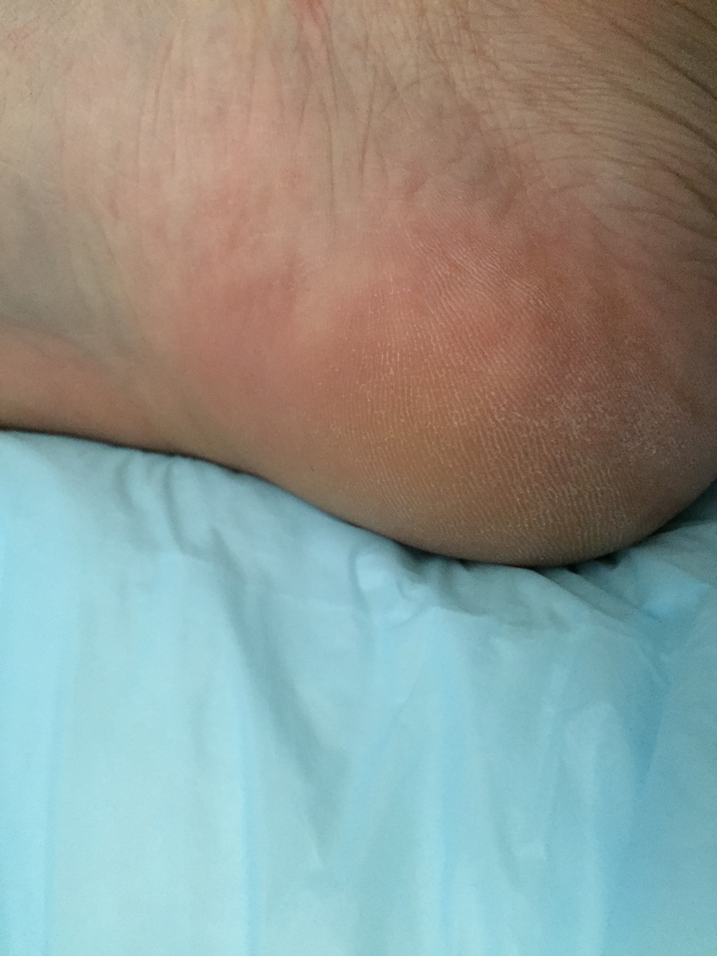 (来源: 遥不可及的天)            这是试用前的照片