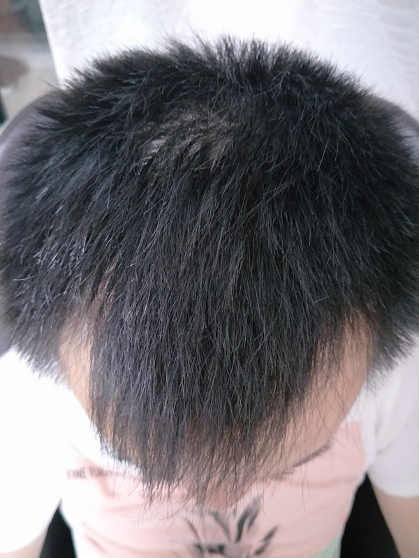 拯救脱发星人大行动性价比真高,真实上手体验,第11张 拯救脱发星人大行动性价比真高,真实上手体验,第11张