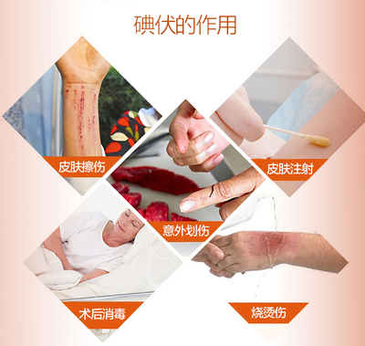 医用碘伏消毒液500ml皮肤伤口粘膜烧烫伤妇科阴道冲洗杀菌碘酒