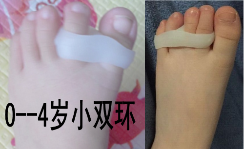 婴幼儿童脚拇指外翻矫正器纠正大拇指和食指重叠脚趾分趾器分离器_双