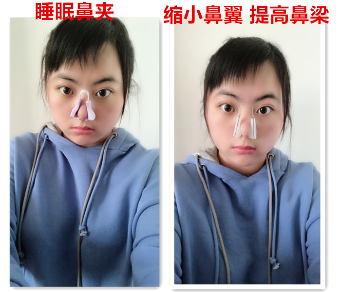 进口二代 鼻梁鼻子增高器鼻子矫正器 美鼻夹 挺鼻夹 夹鼻器