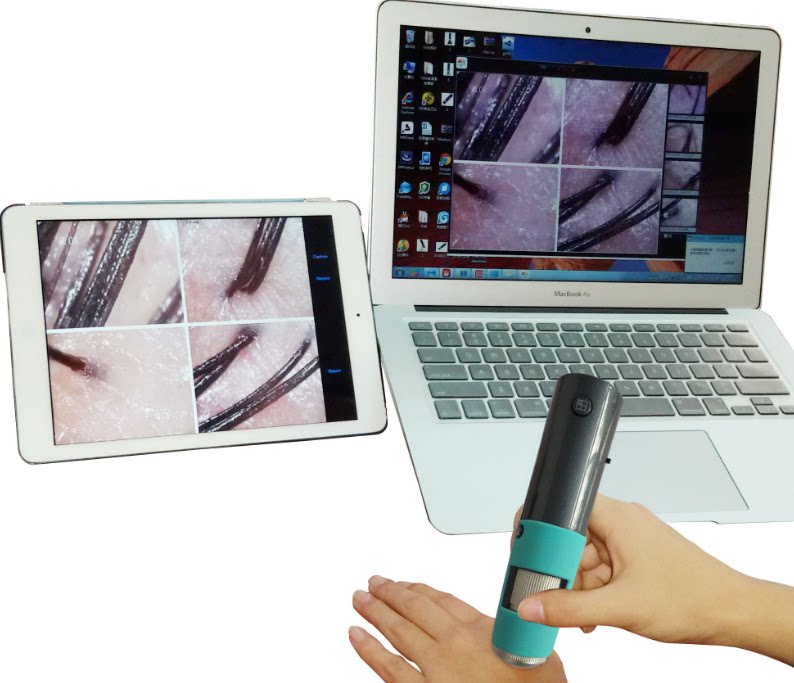 高倍高清无线连接智能手机平板电视 头皮检测仪器 毛孔检测仪