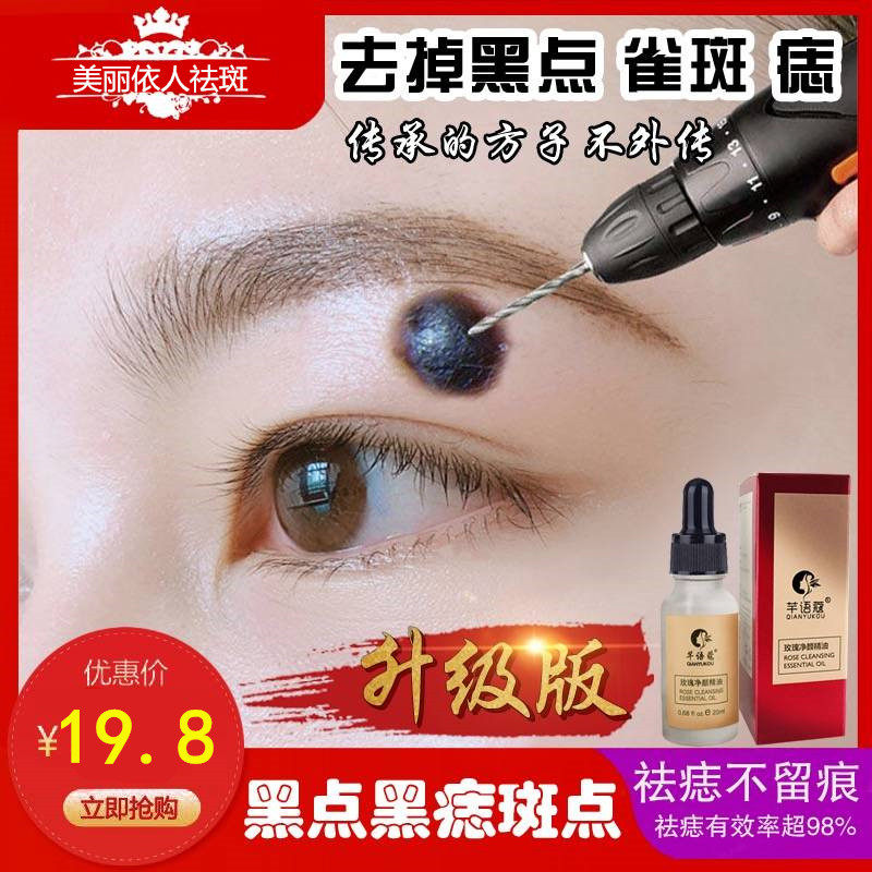 点痣水无痕正品水点痣药水脸部祛痣膏修复去黑痣神器
