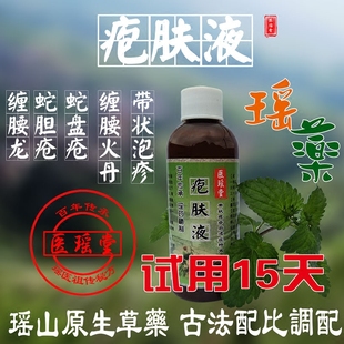 蛇胆疮蛇盘疮后遗症神经刺痛缠腰龙蛇串疮火丹膏疱肤液非烟袋油