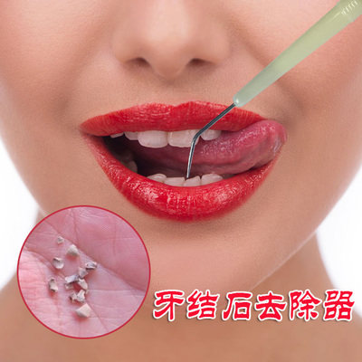 牙结石去除器 牙垢_牙齿美白去牙结石洗牙器刮牙洁牙清除去除牙石牙垢