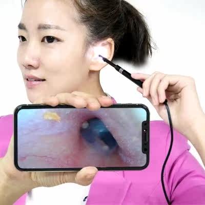 9摄像头发光掏耳a优惠券