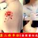 老师生病了还坚持为我们上课 作文 杜老师说可以祛除汗管瘤到底能不能相信?