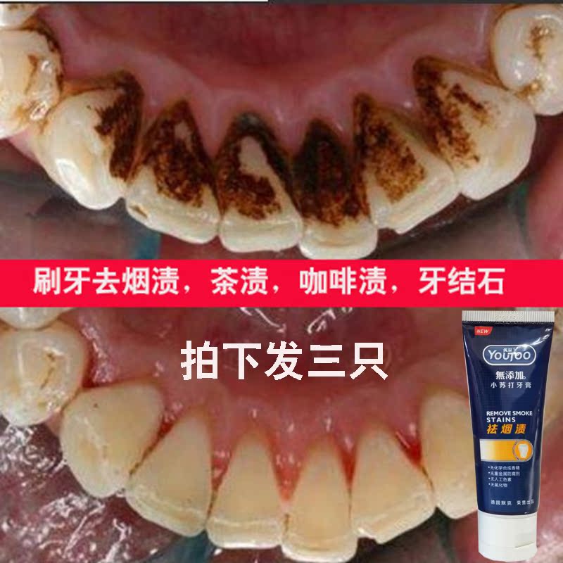 口益清钻石超白牙膏美白牙齿去黄去烟渍去口臭除渍增白3只家庭装