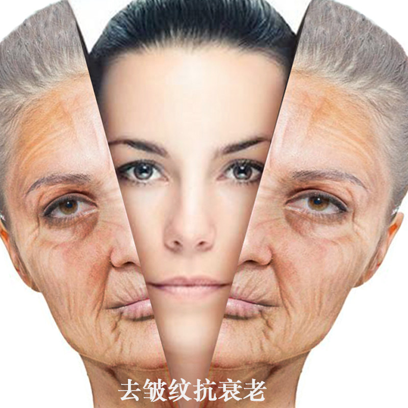 去皱纹抬头纹大额优惠券