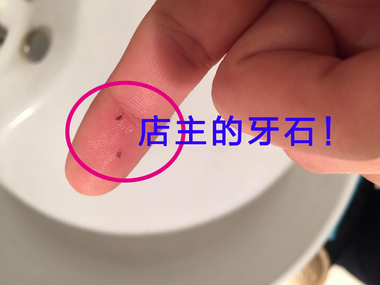 去除牙結石的方法有哪些？
