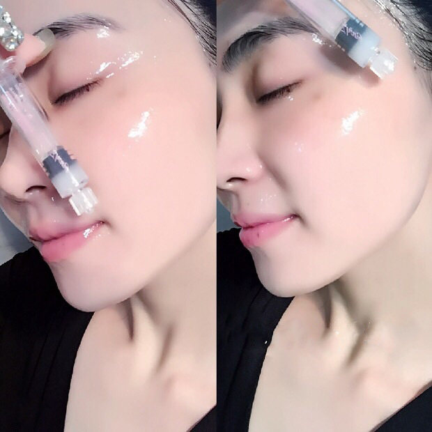 『买2送1』涂抹式水光针玻尿酸精华原液补水保湿紧致抗皱虾青素