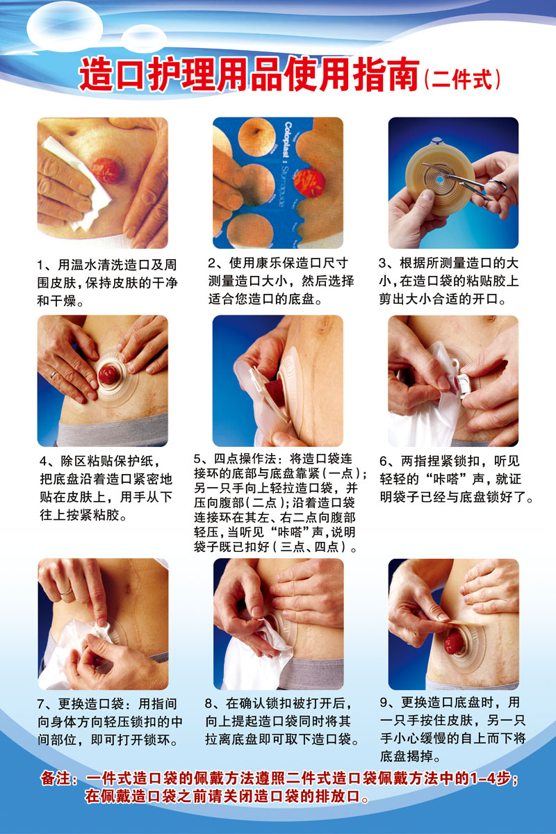 热销造口护理用品