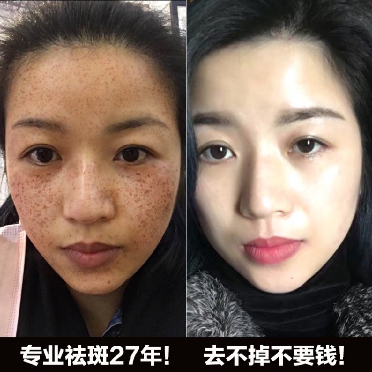 佳雪芦荟清新保湿乳液80g补水控油滋润紧致护肤面霜春夏女士 - 小轩窗