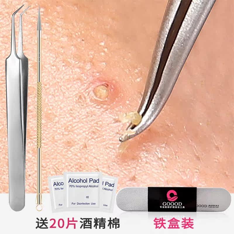 祛痘针 粉刺针 1支装
